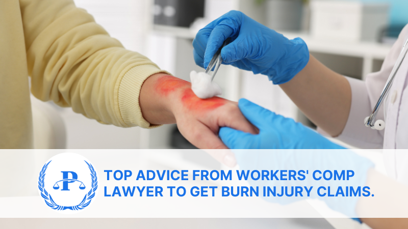 Top advice from workers' comp lawyer to get Burn injury claims.