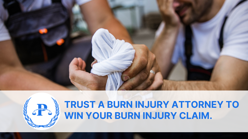_Trust a Burn Injury Attorney to Win Your Burn Injury Claim.  | Pistiolas Law
