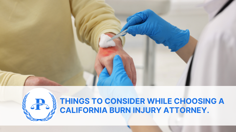 Things to consider while choosing a California burn injury attorney. | Pistiolas Law