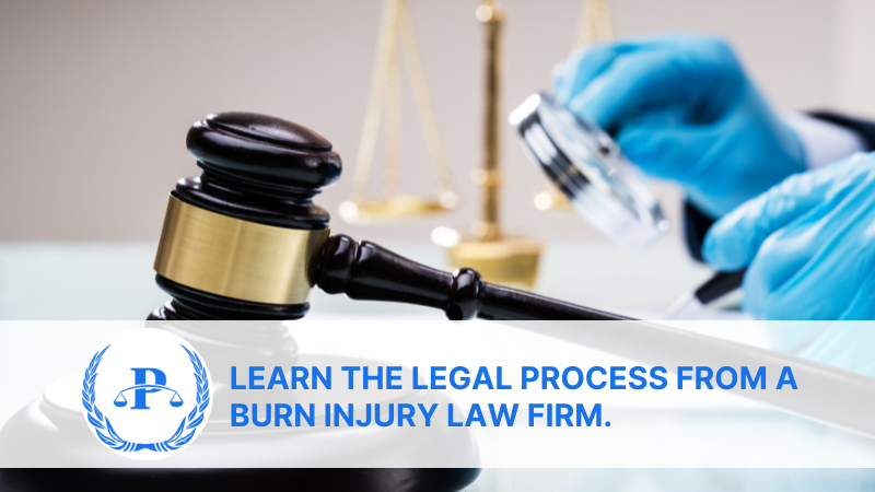 Learn the Legal Process from a Burn Injury Law Firm.