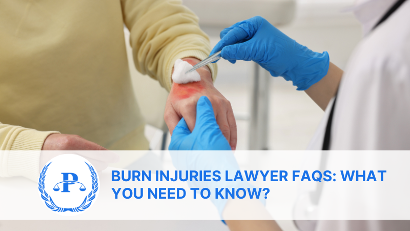 Burn Injuries Lawyer FAQs: What You Need to Know?