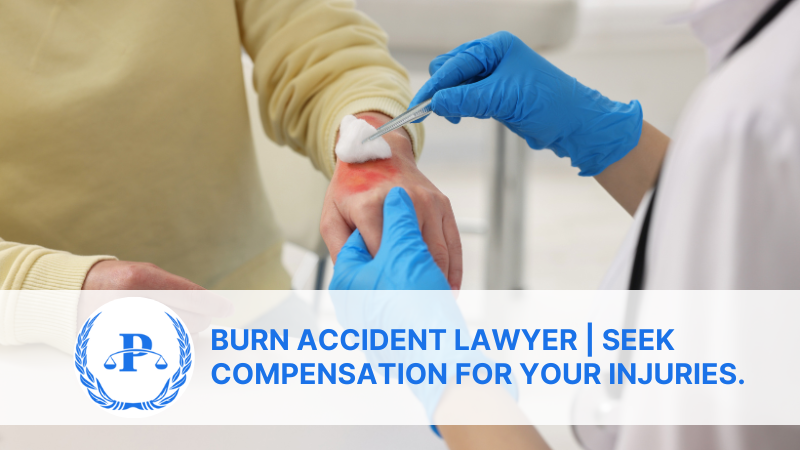 Burn Accident Lawyer | Seek Compensation for Your Injuries.