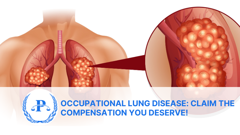 Occupational Lung Disease: Claim the Compensation You Deserve!